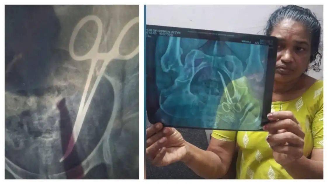 ഉഷയുടെ വയറ്റിലുണ്ടായിരുന്ന ഉപകരണം ശസ്ത്രക്രിയയിലൂടെ പുറത്തെടുത്തു,  ഇനി കോടതിയില്‍ ഹാജരാക്കും